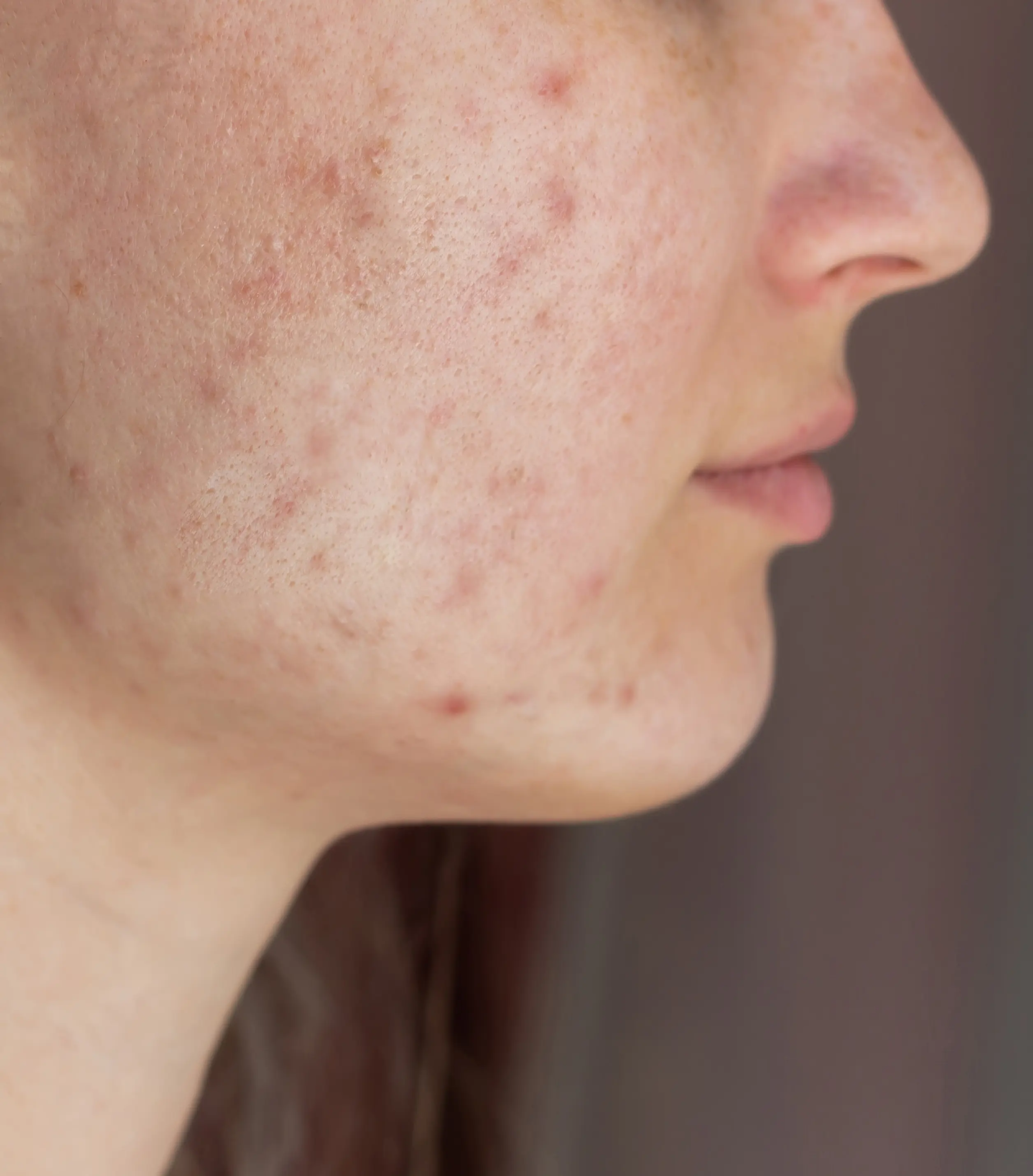 Before Treatment