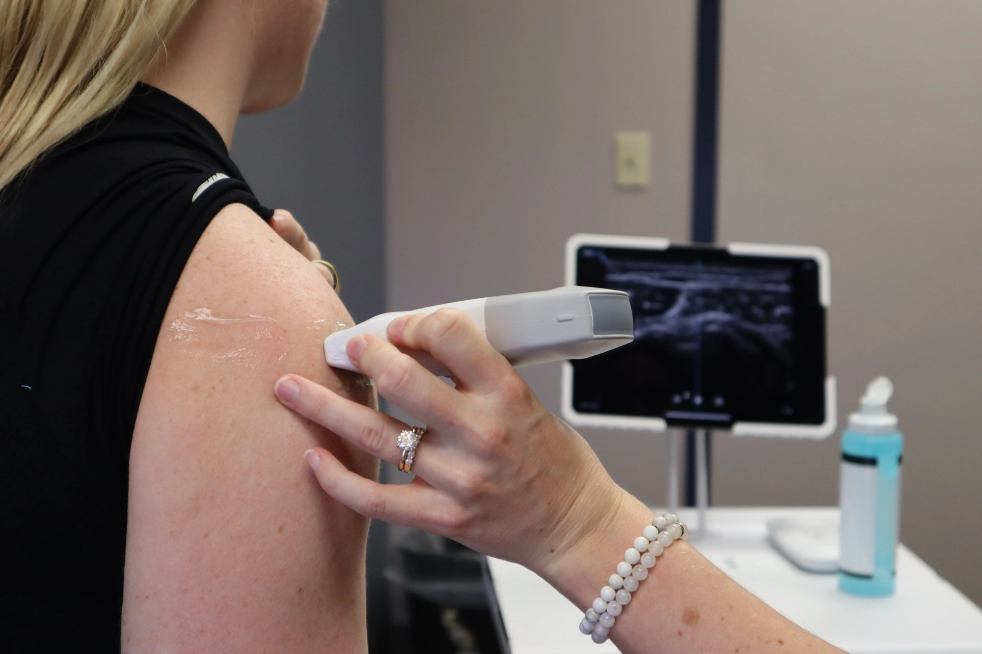 GFC Treatment in progress