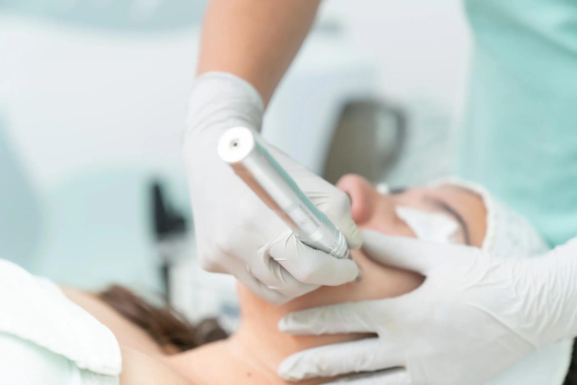 Microdermabrasion & Microneedling