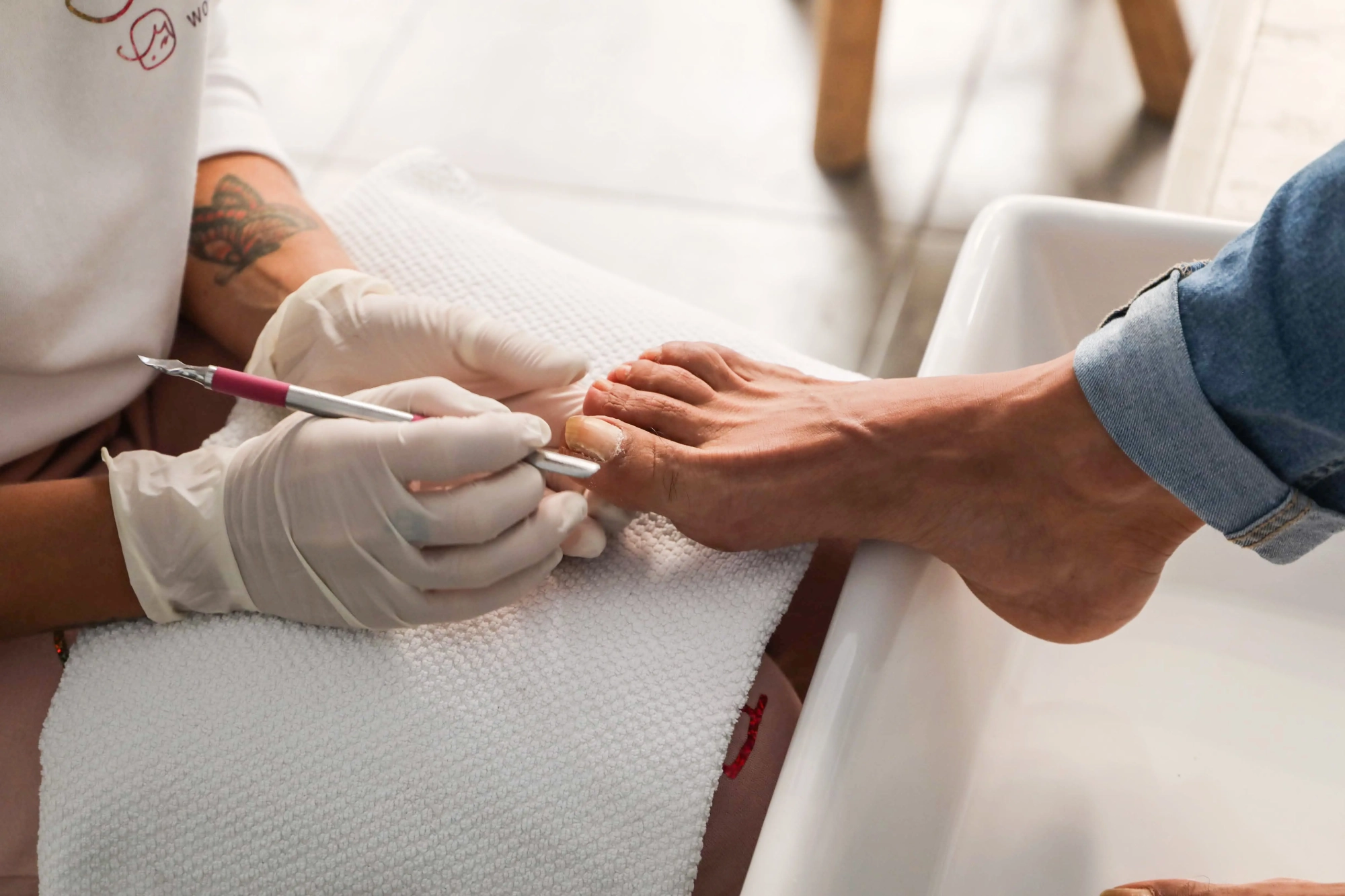 Nail & Other Procedures